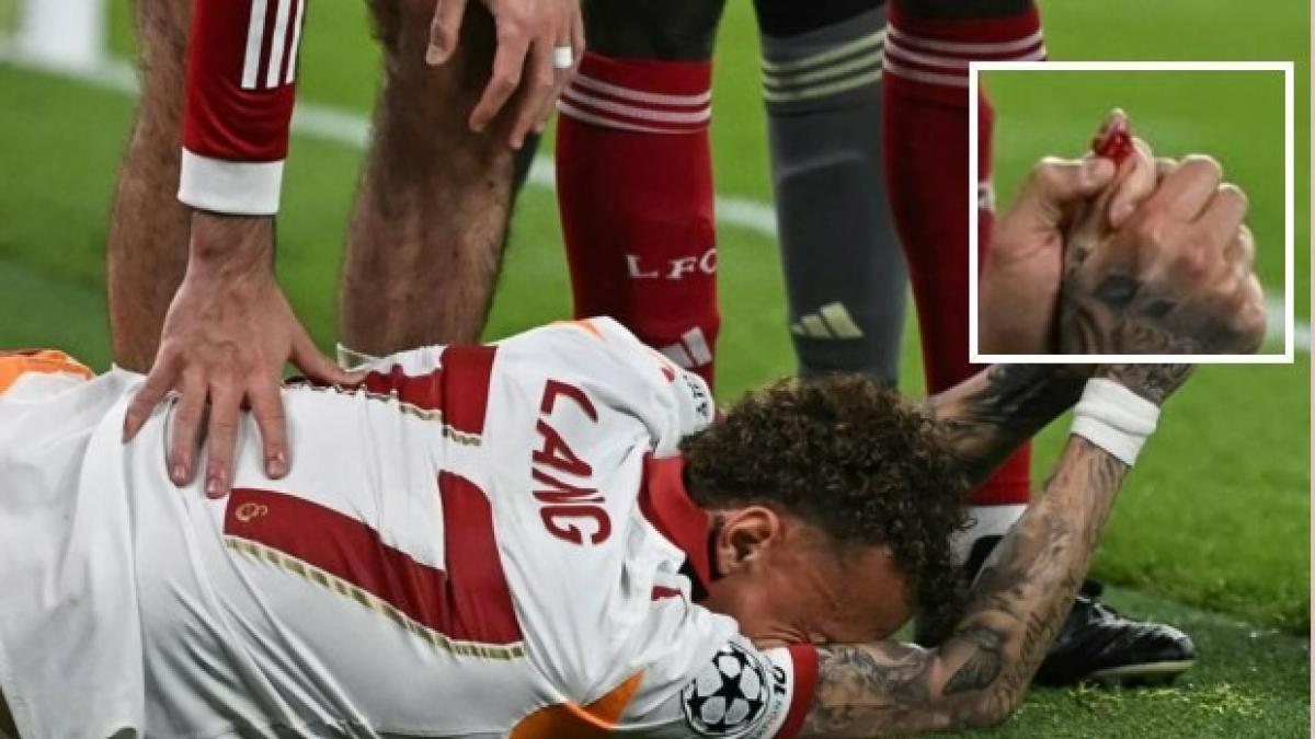 Lang shock, cade sui cartelloni e si apre il pollice. Portato in ospedale: "Forse subito operato"