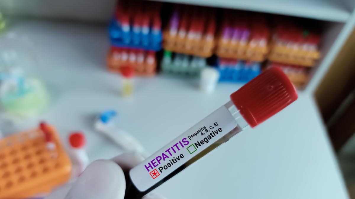 Epatite A: casi in aumento in Italia. Cosa fare a tavola per evitare il contagio