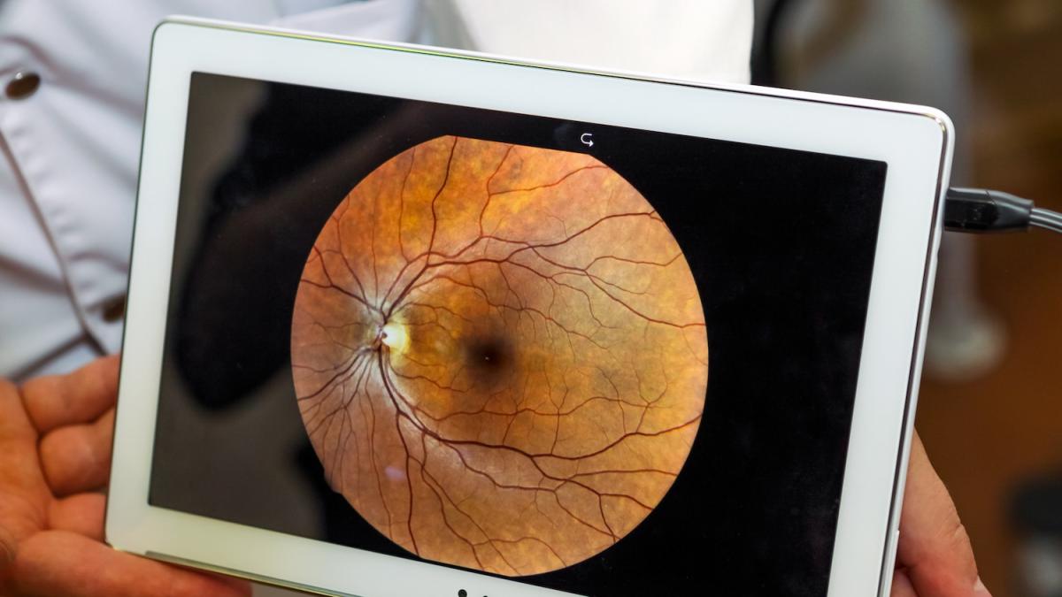 Lo sperma di maiale può aiutare nella somministrazione di farmaci antitumorali: lo studio