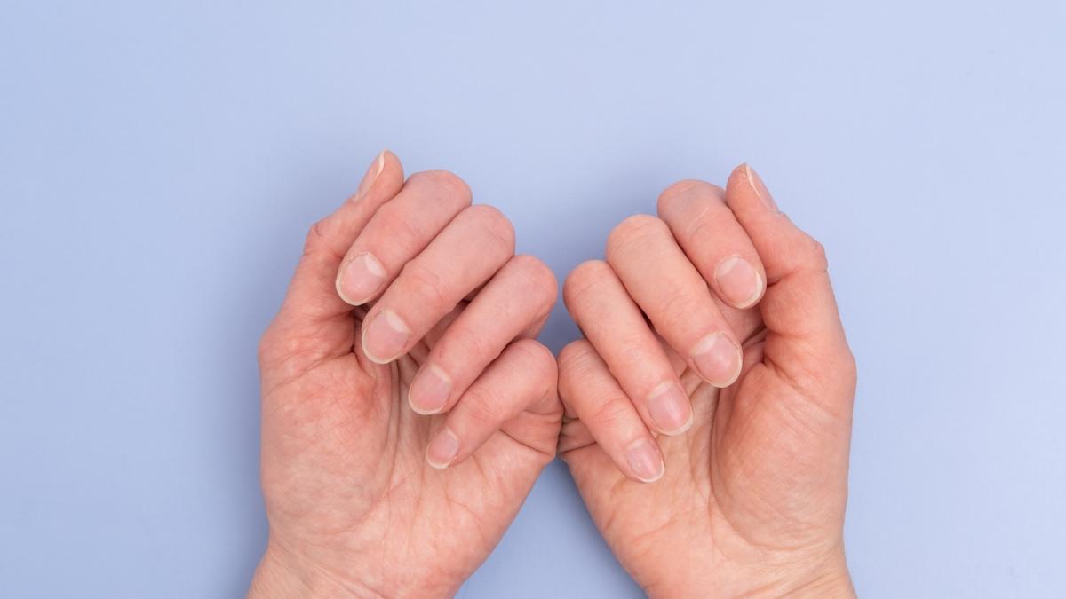 Melanoma ungueale: cos'è e come scovarlo
