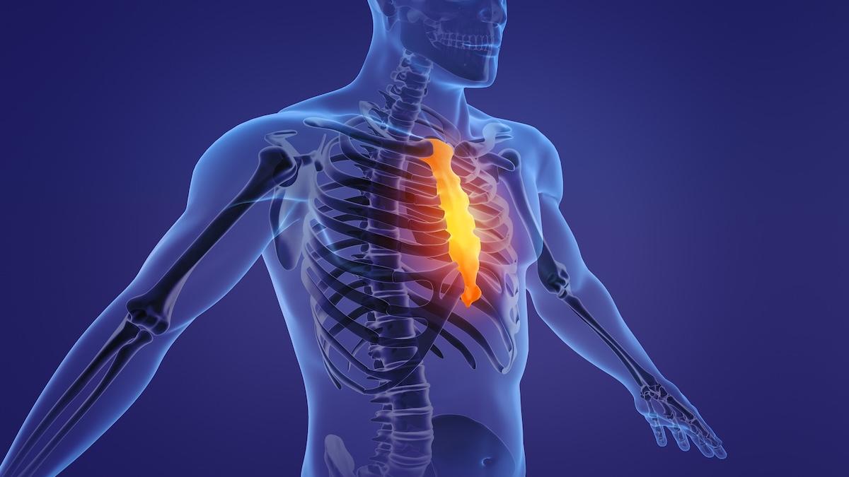 Legamento costoxifoideo: sintomi e cura per il dolore sotto lo sterno