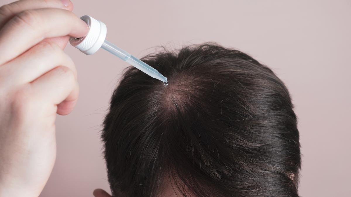 alopecia la scienza riscopre un antico rimedio cinese da Gazzetta.it alopecia la scienza riscopre un antico rimedio cinese