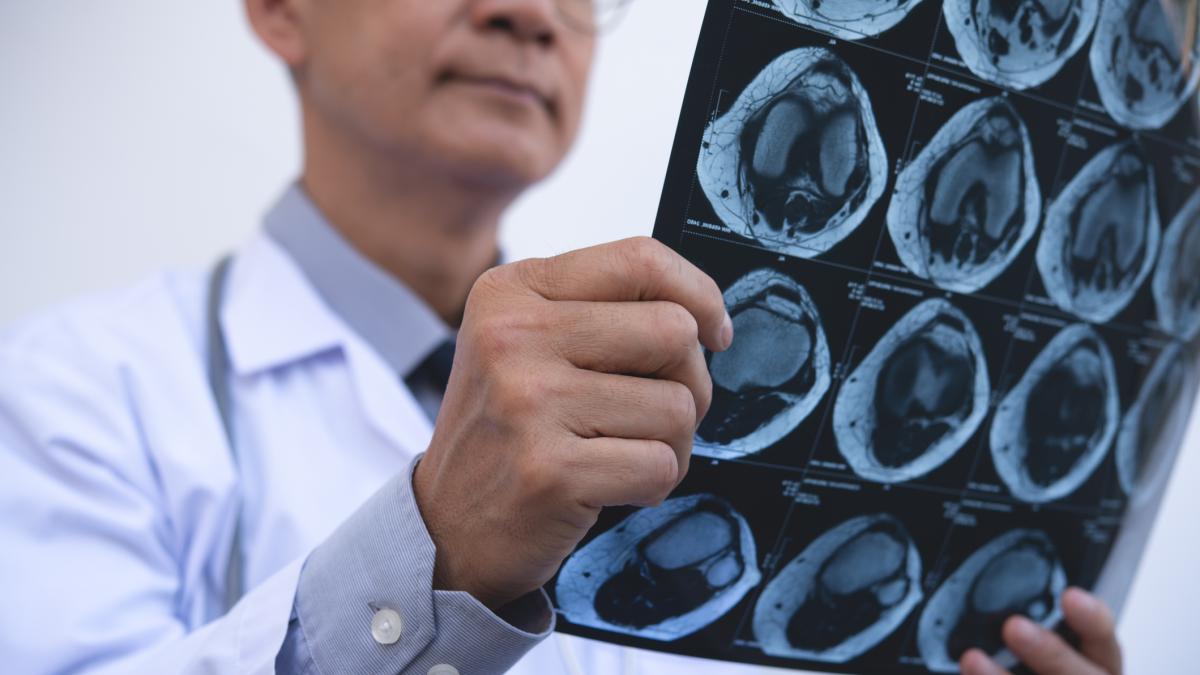 come funzionano le visite mediche dei calciatori tutti i controlli dalle risonanze alle radiografie da Gazzetta.it come funzionano le visite mediche dei calciatori tutti i controlli dalle risonanze alle radiografie