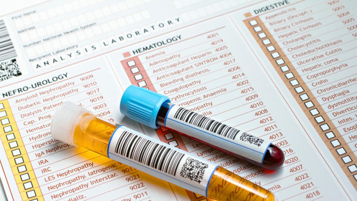 tumore alla vescica addio cistoscopia un test fai da te scova 9 casi su 10 da Gazzetta.it tumore alla vescica addio cistoscopia un test fai da te scova 9 casi su 10