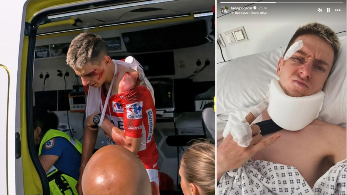 pogacar e la caduta alla vuelta la diagnosi l intervento quando pu242 tornare tutti gli scenari da Gazzetta.it pogacar e la caduta alla vuelta la diagnosi l intervento quando pu242 tornare tutti gli scenari